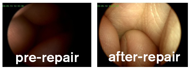 rigid endoscope repair